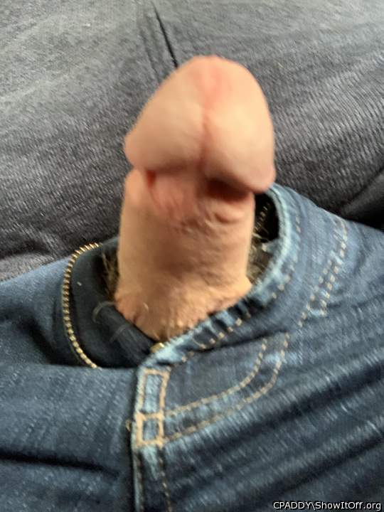 My Circumcised Dick-Do you like it?