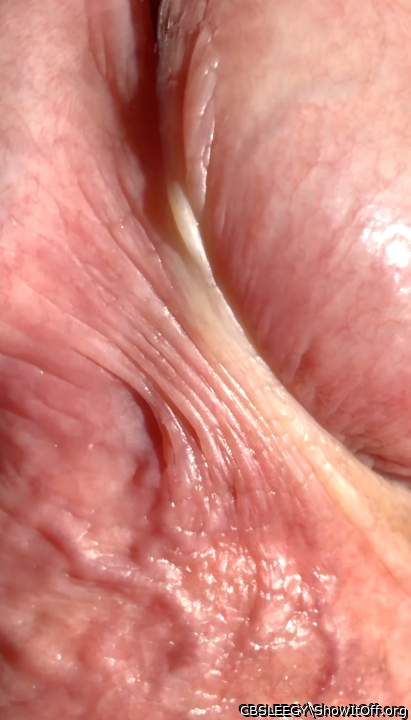 How many frenulum stretches do you see?