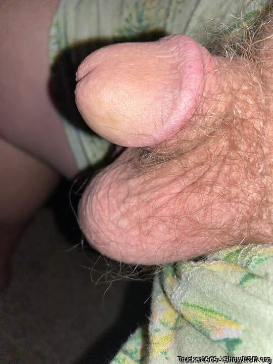 Nice glans and foreskin circumcised  