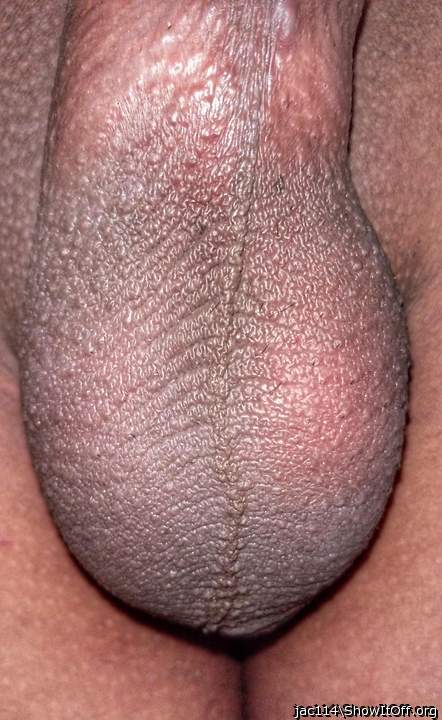 Testicles Photo from jac114