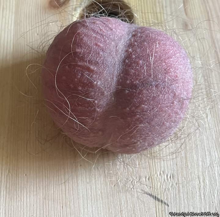 Testicles Photo from Cbtandjoi