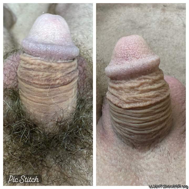Hairy vs. shaved