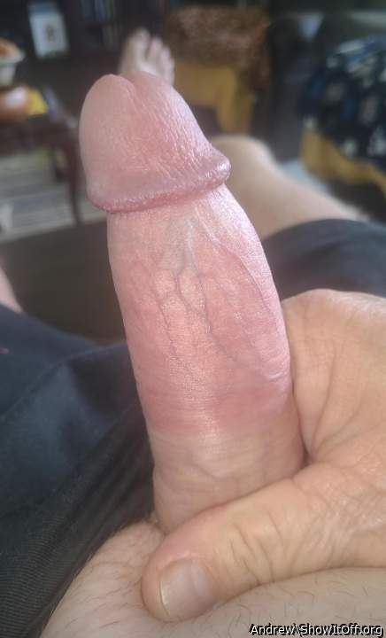 Photo of a penis from Andrew