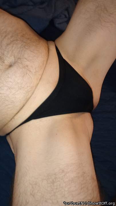 Photo of a middle leg from CuriOus1NU