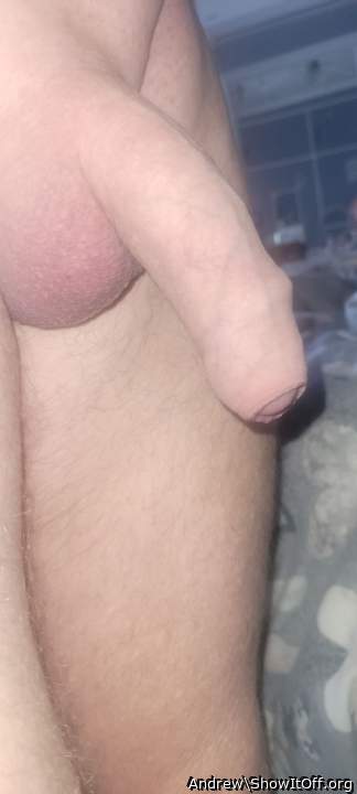 Photo of a short leg from Andrew
