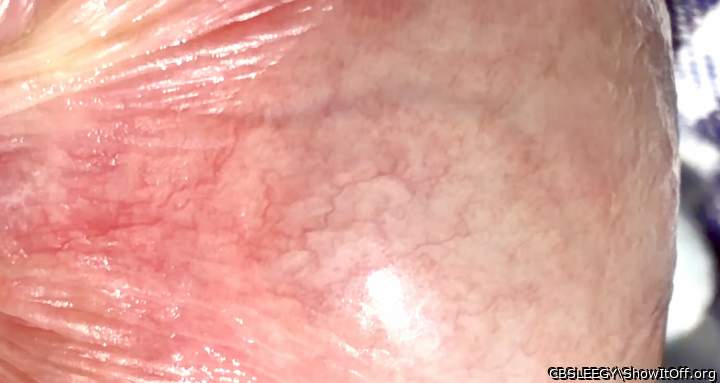 Vein structure in the helmet!