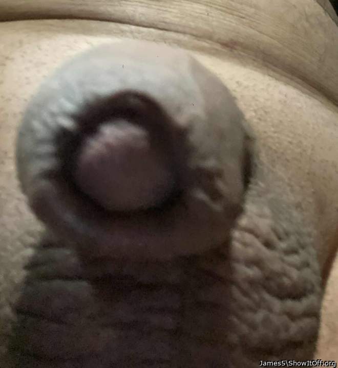 Haven't had a foreskin since I was circumcised at 4yrs old.