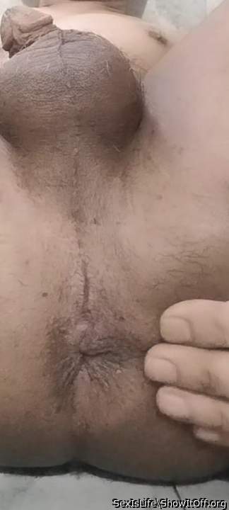 My asshole