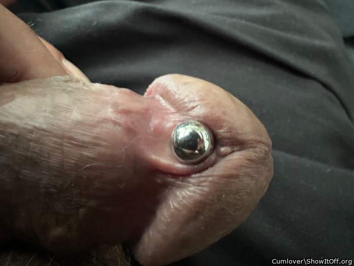 Foreskin Gone