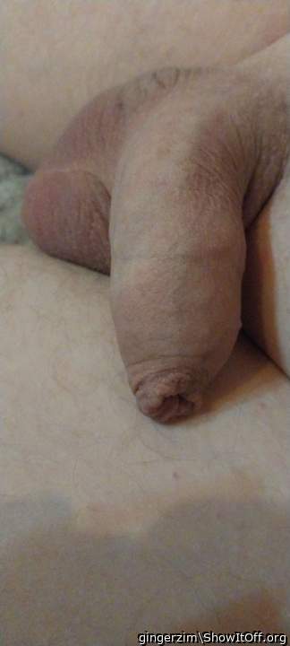 Photo of a penis from gingerzim