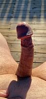 image of a penis