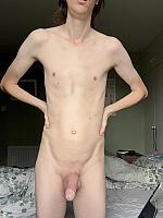 penile