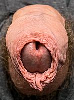 dick pic